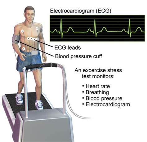 treadmill stress test speed